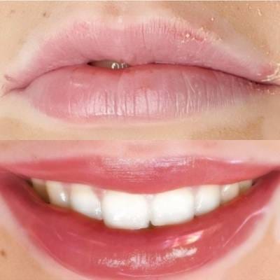 LIP BLUSHING